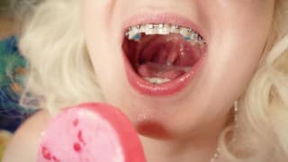 Braces Fetish: mukbang video.