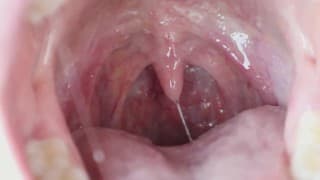 My Sexy Wet Uvula - 高清预告片